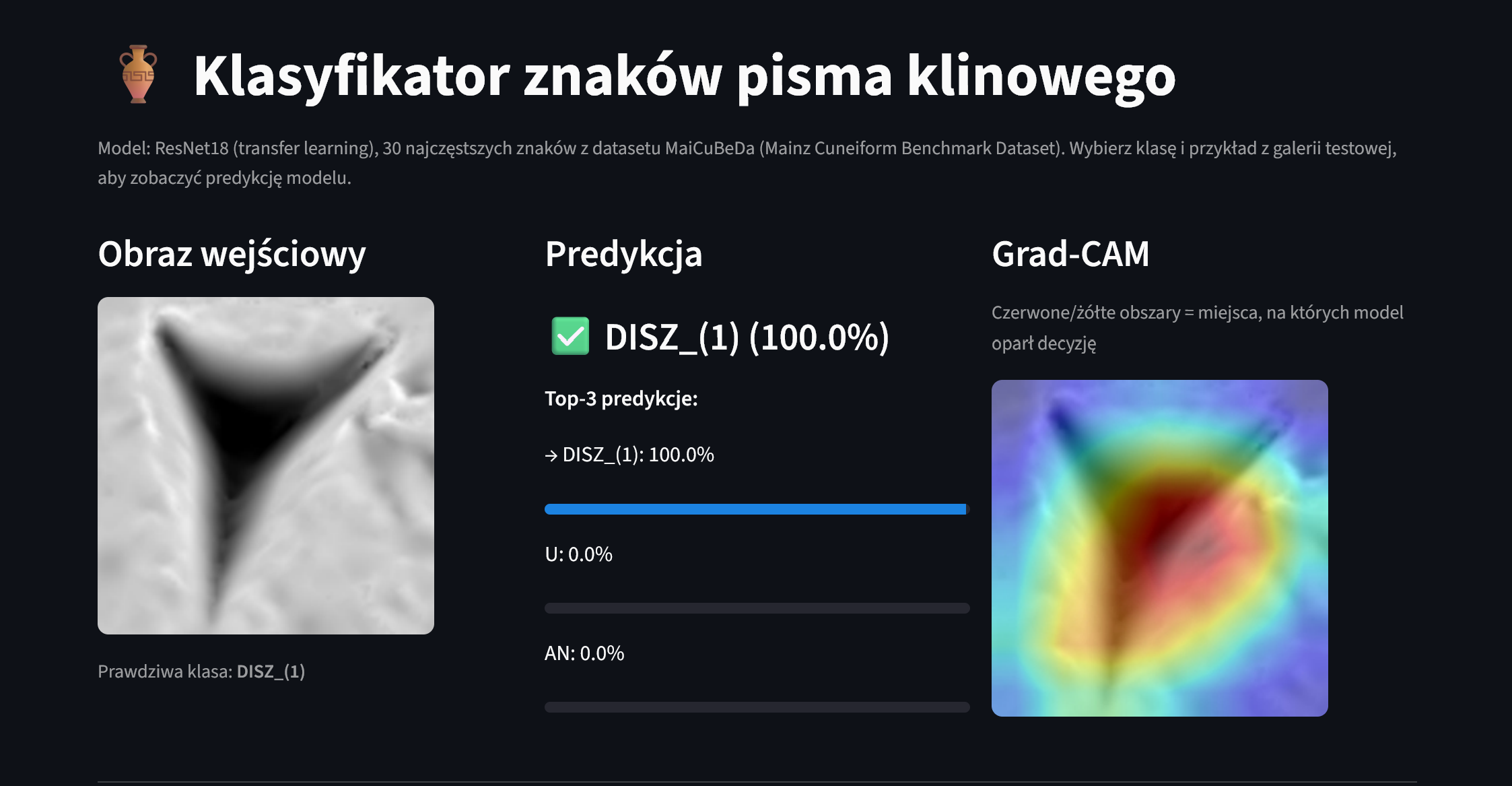 App interface: prediction and Grad-CAM visualization