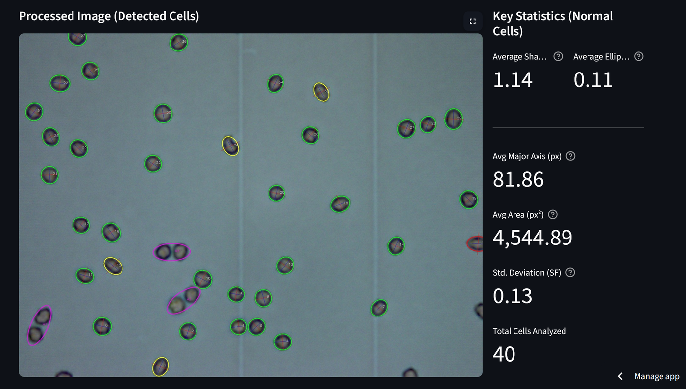 Detected cells with per-cell shape classification and live statistics