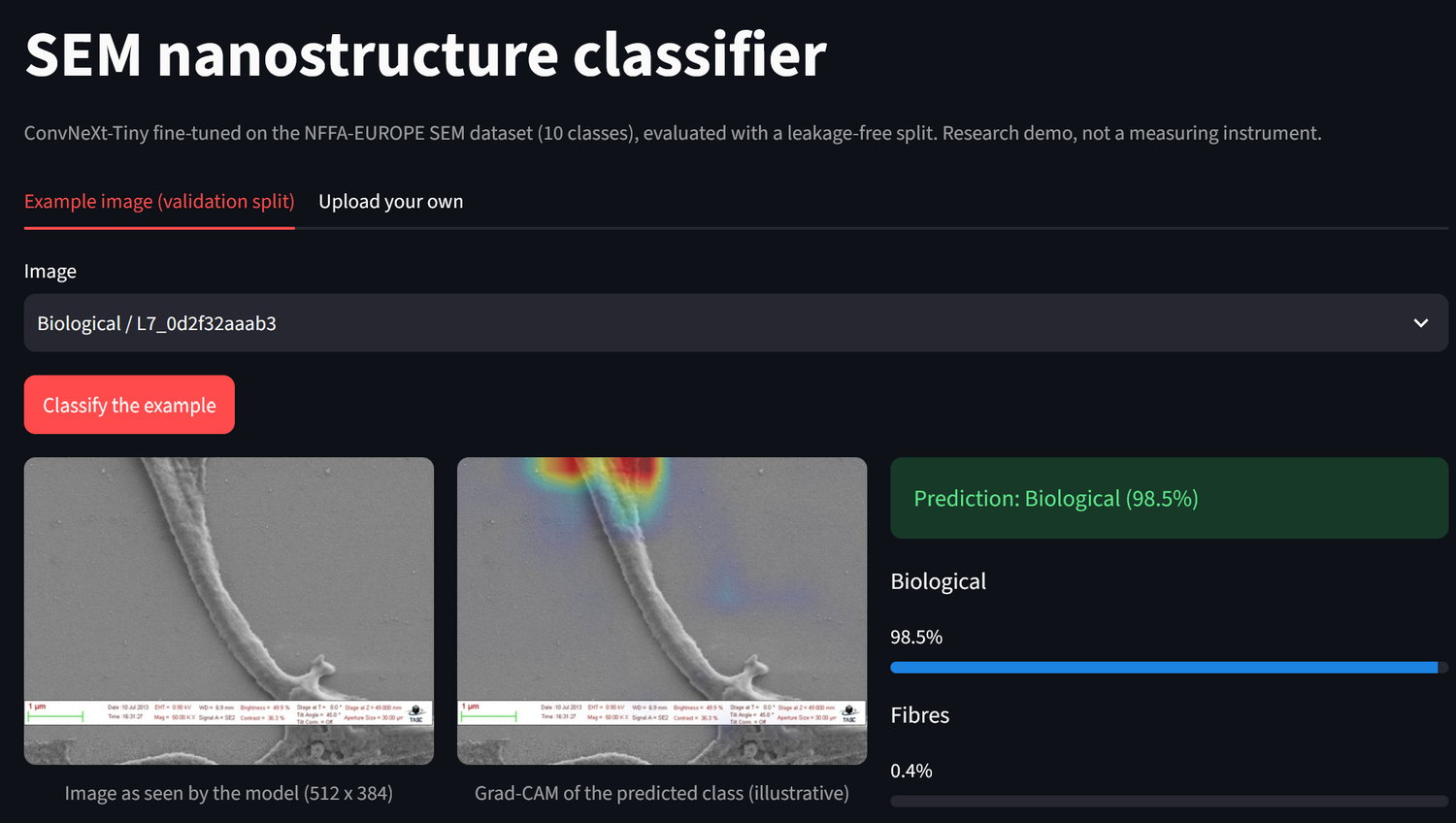 The Streamlit demo: top-3 predictions with calibrated confidence and a Grad-CAM overlay